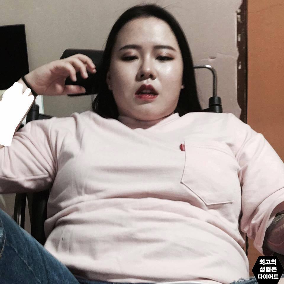 Cô gái xinh đẹp Hàn Quốc tung ảnh quá khứ béo múp, xấu xí - 2