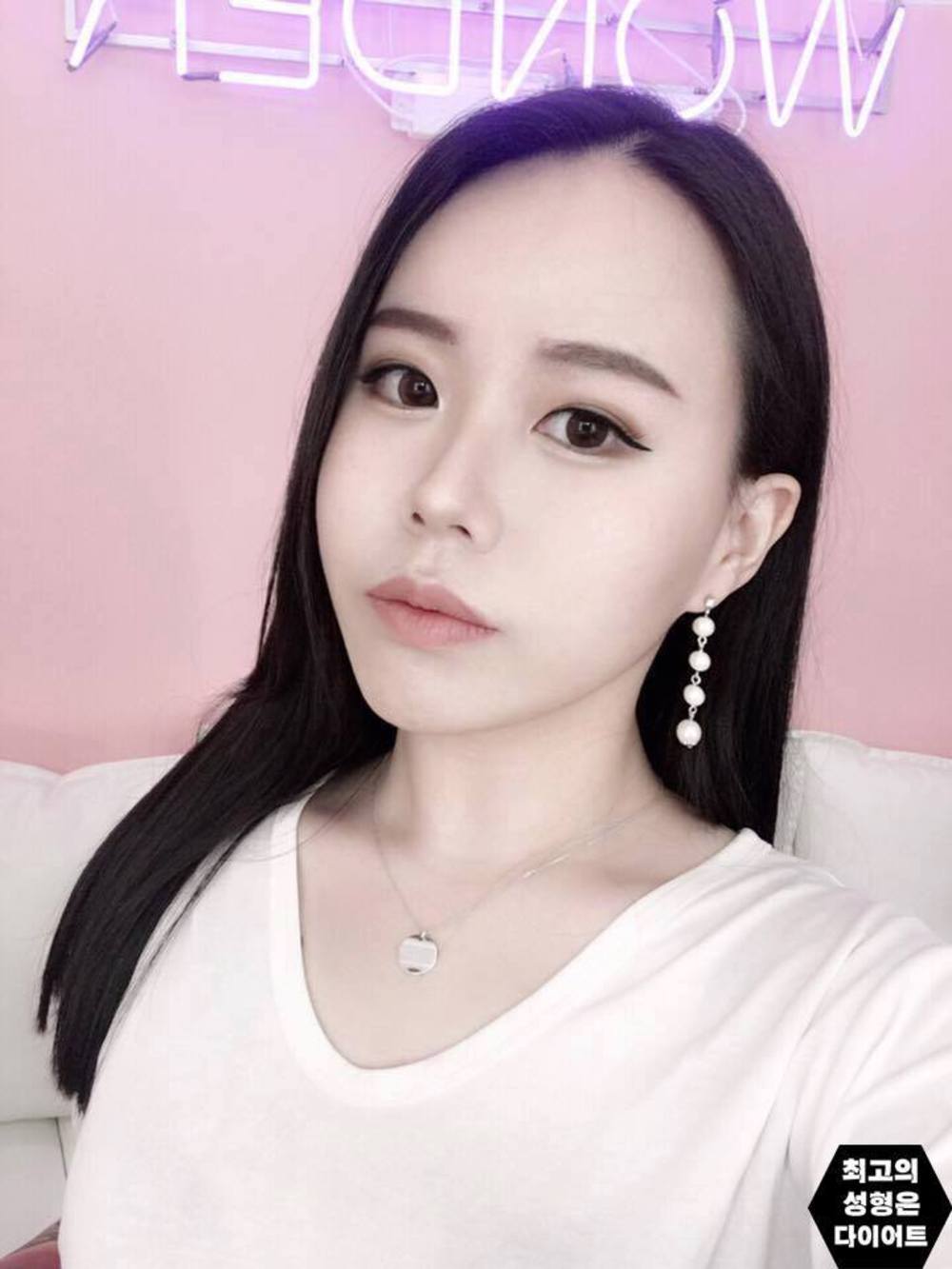 Cô gái xinh đẹp Hàn Quốc tung ảnh quá khứ béo múp, xấu xí - 5