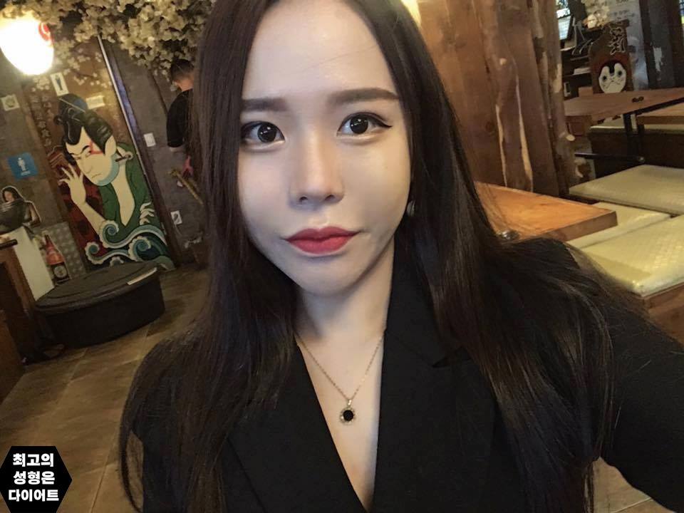 Cô gái xinh đẹp Hàn Quốc tung ảnh quá khứ béo múp, xấu xí - 6