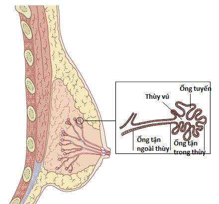 Giãn ống tuyến vú: Nỗi lo của phụ nữ