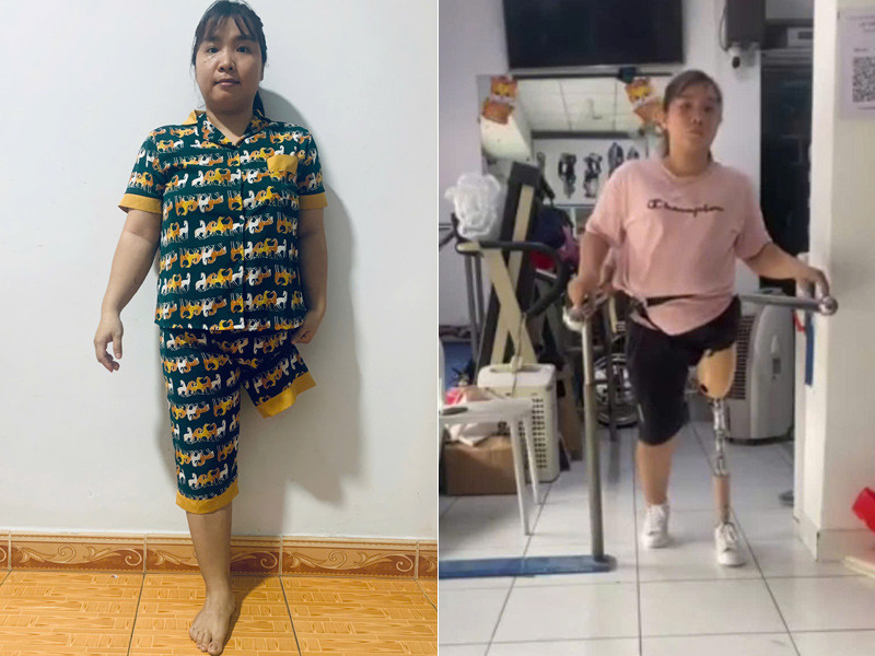 Tai nạn kinh hoàng cướp đi mẹ ruột và 1 chân, cô gái được mẹ chồng bù đắp tất cả