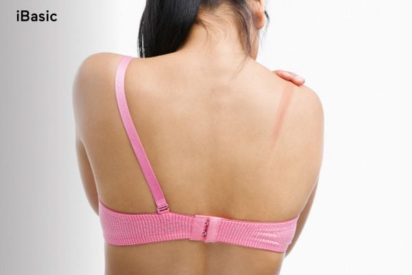 10 Hậu quả của việc mặc không đúng kích thước áo ngực nàng nên biết | iBasic