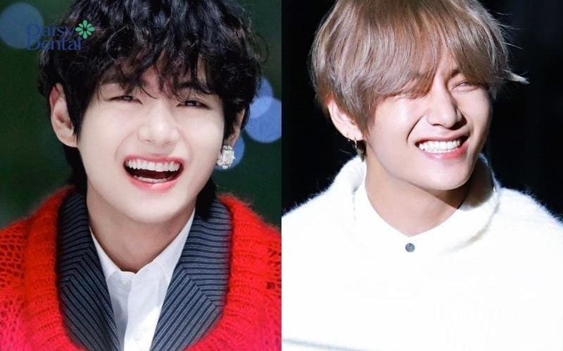 Hình ảnh cười tươi của nam ca sĩ Hàn - V (BTS)