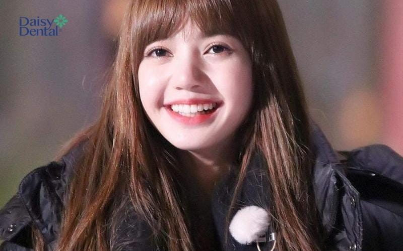 Nụ cười ngọt ngào giúp nhan sắc thăng hạng - Lisa (Blackpink)