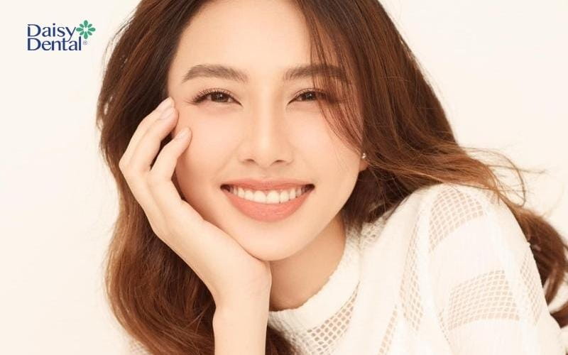 Hoa hậu Thùy Tiên - Một trong những người sở hữu nụ cười đẹp nhất thế giới