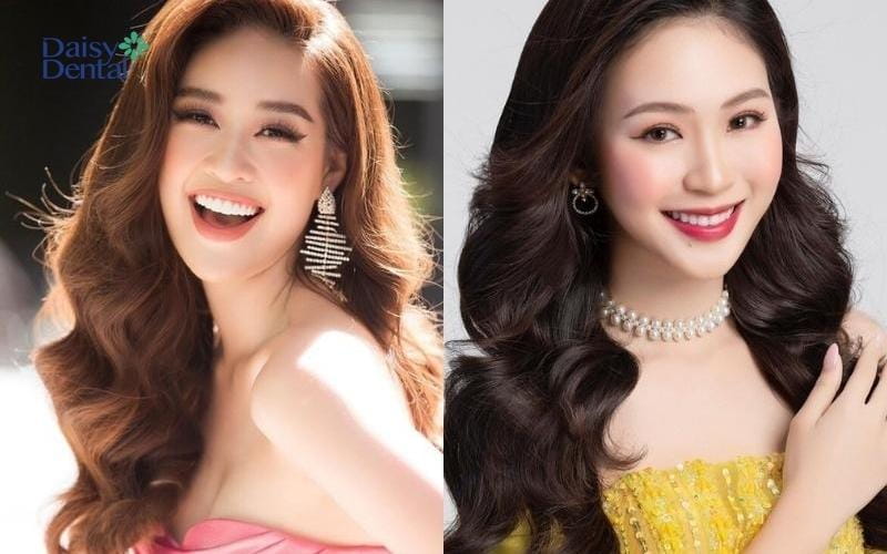 Nụ cười thần thái, “bật” nét riêng của các Hoa hậu
