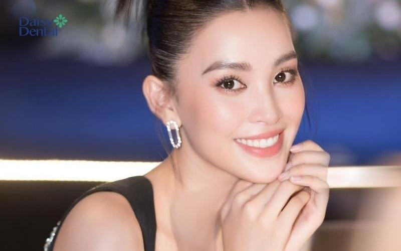 Hoa hậu Tiểu Vy sở hữu nụ cười tươi tắn, rạng rỡ