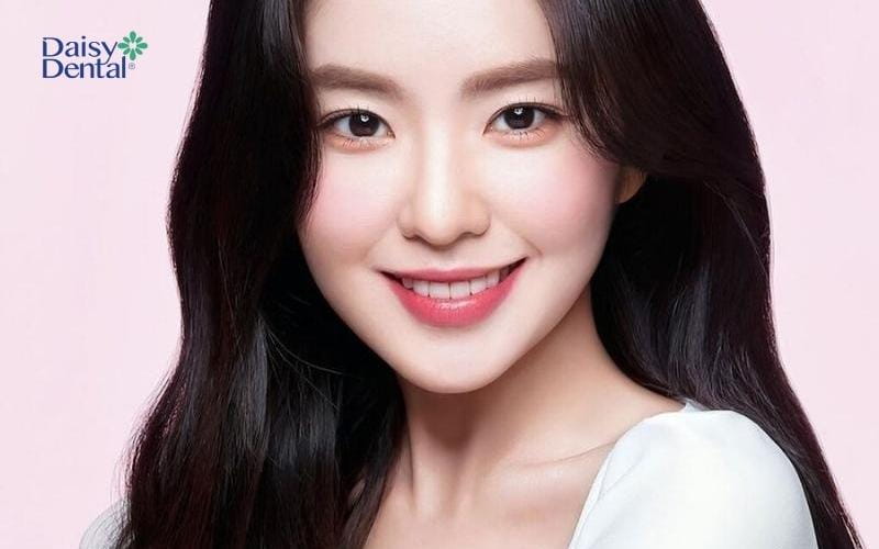 Nụ cười đẹp chuẩn tỉ lệ vàng của nữ ca sĩ Irene