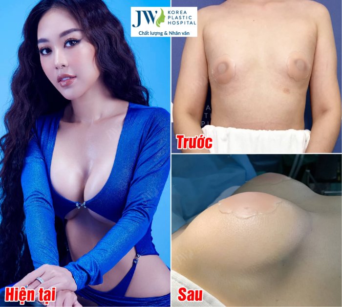 nang-nguc-jw