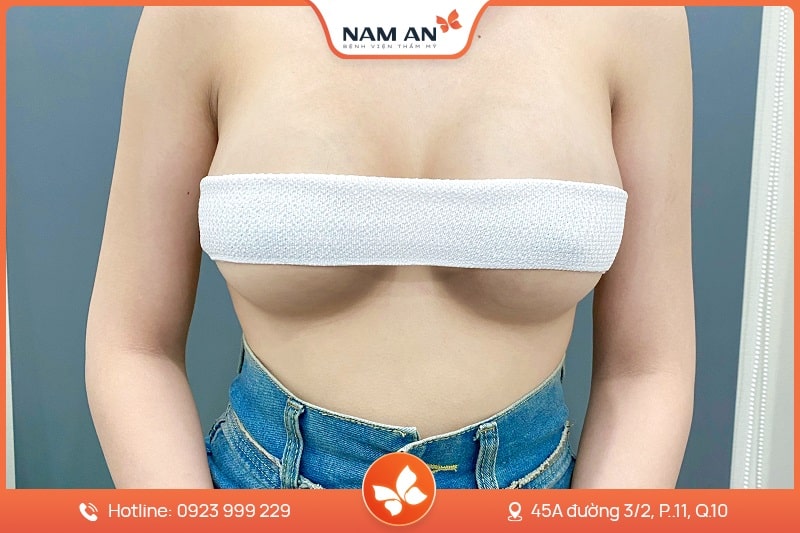 Thu Gọn Quầng Vú Tỉ Lệ Vàng, Không Lộ Sẹo Tại Nam An (3)