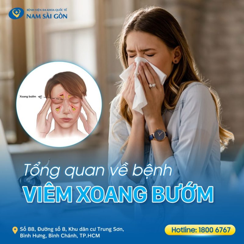 VIÊM XOANG BƯỚM – NGUYÊN NHÂN, DẤU HIỆU, BIẾN CHỨNG VÀ CÁCH ĐIỀU TRỊ