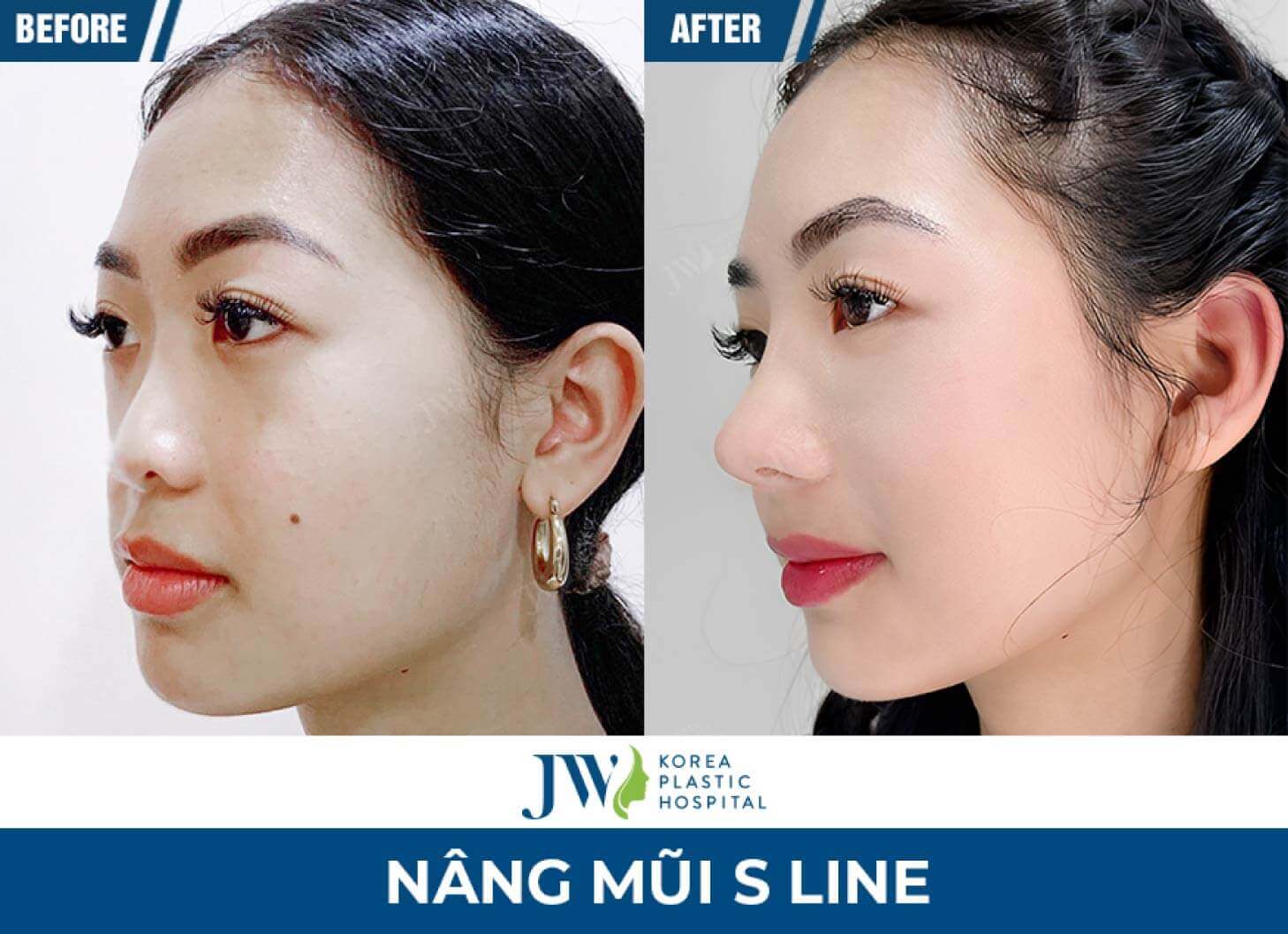 nang mui s line 5