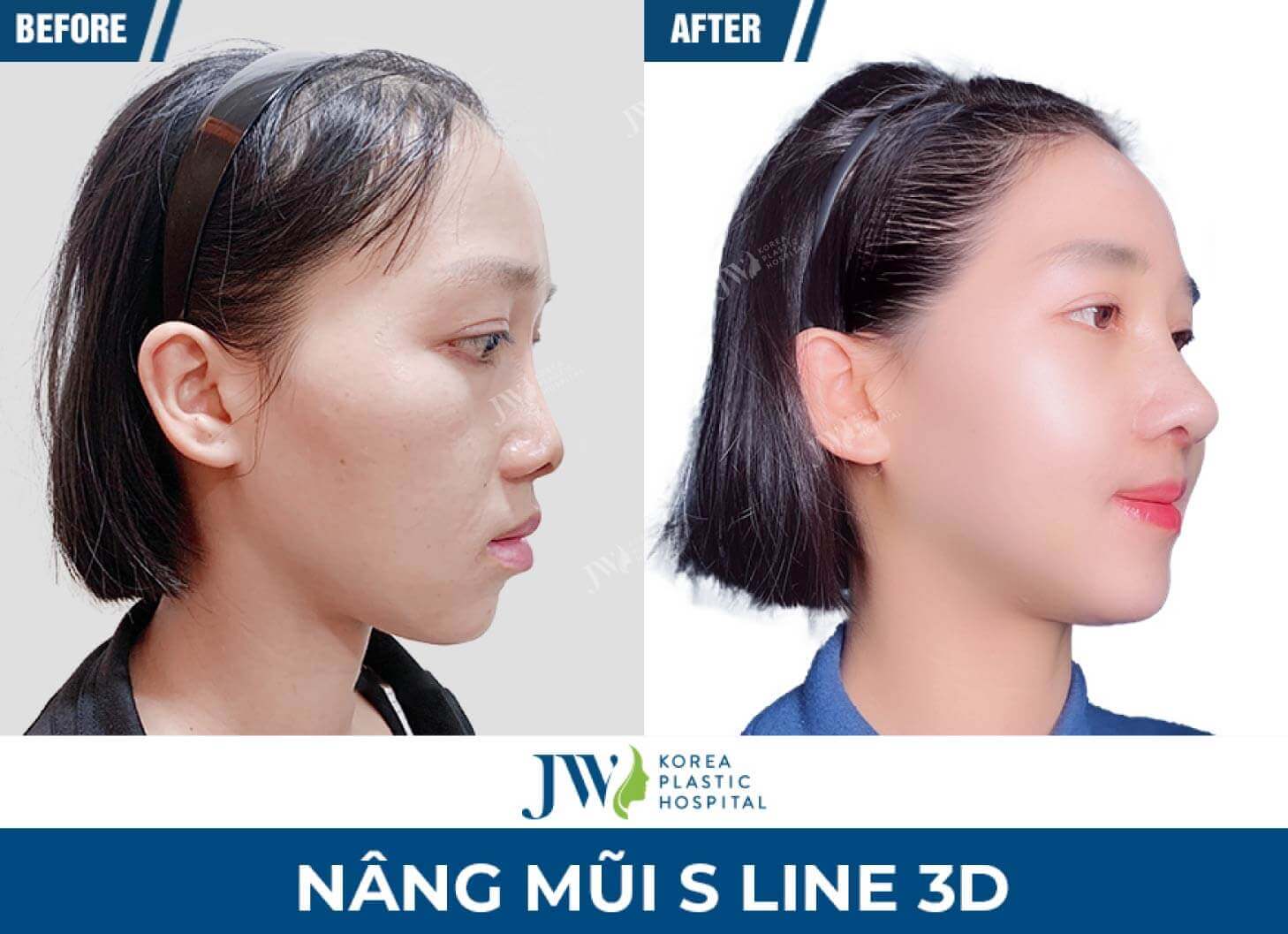 nang mui s line 3d 1