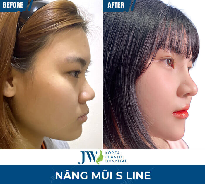 nang mui s line 6