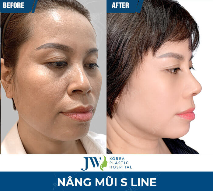 nang mui s line tai jw 1