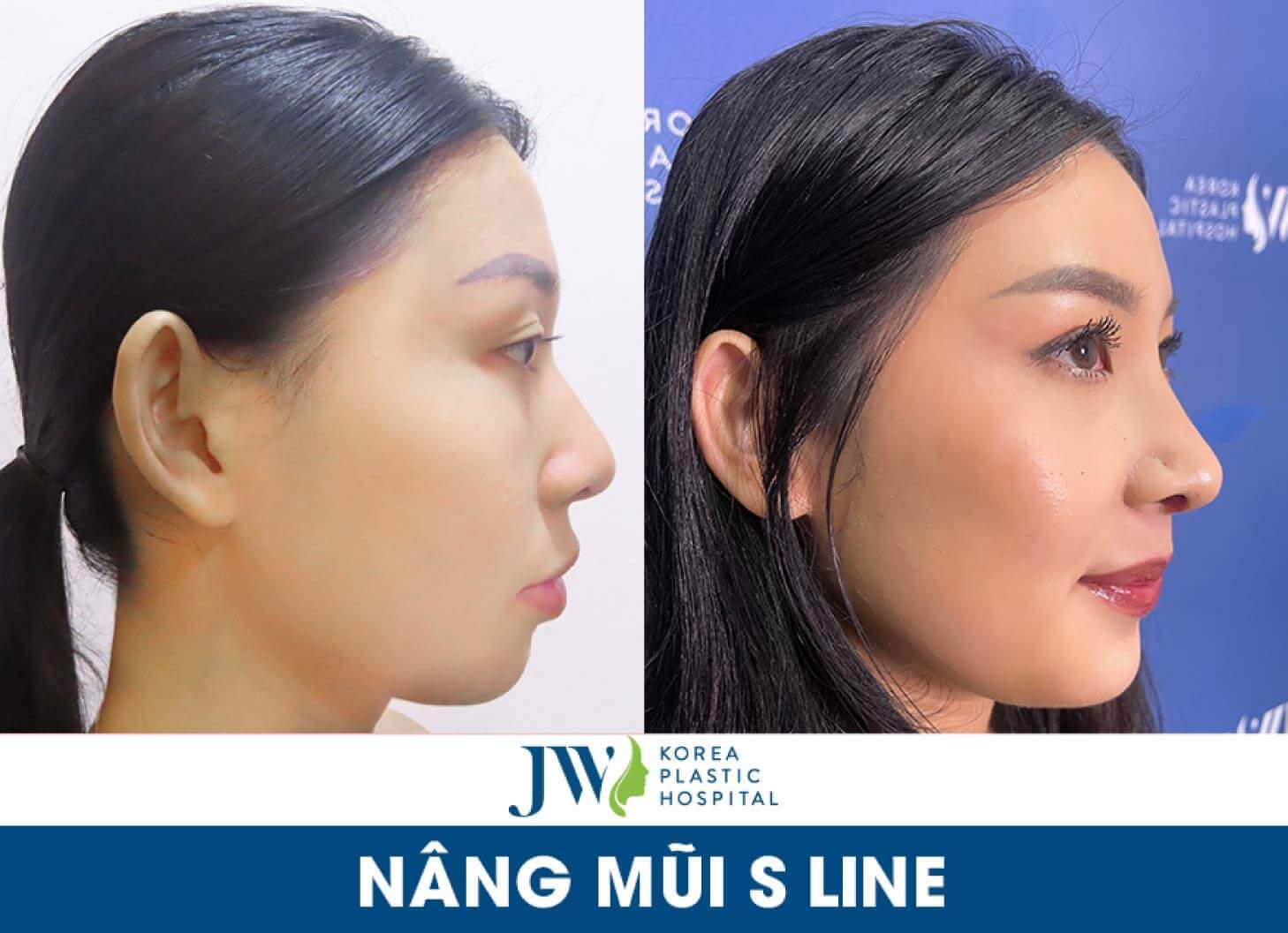 nang mui s line tai jw
