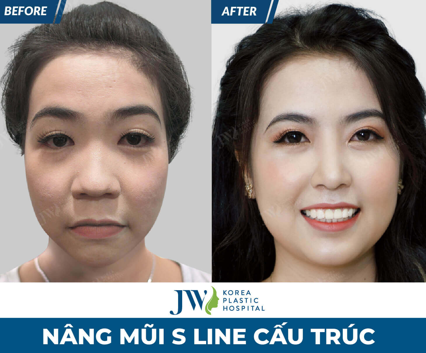 nang mui dep