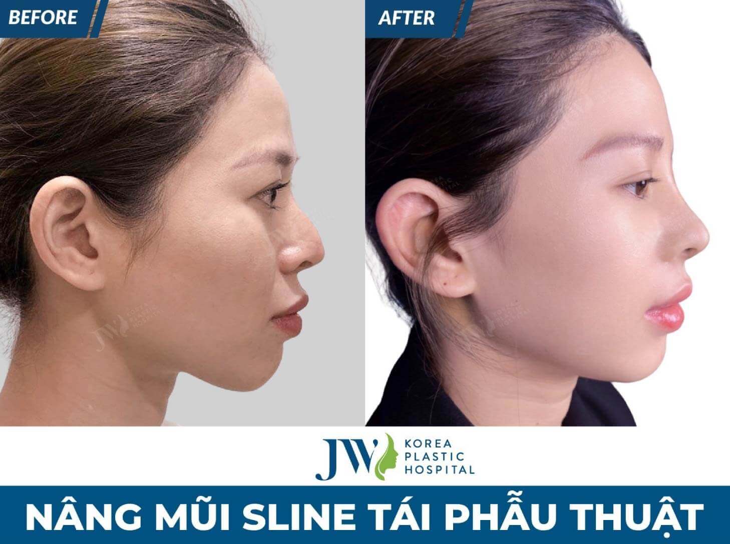 nang mui s line