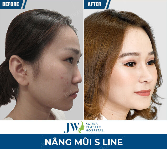 nang mui