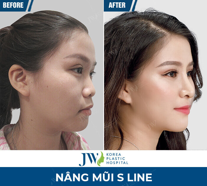 nang mui 1