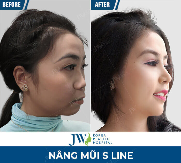 nang mui s line 1