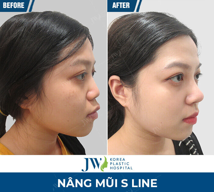 nang mui s line 2