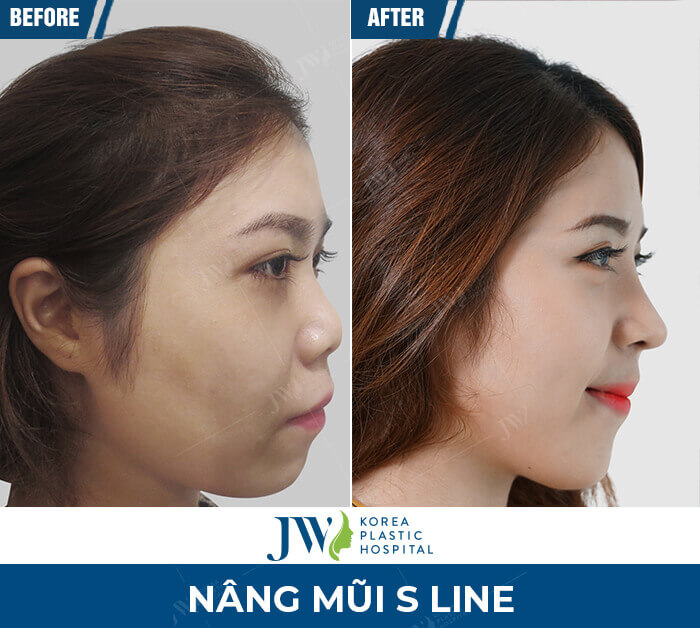 nang mui s line 3