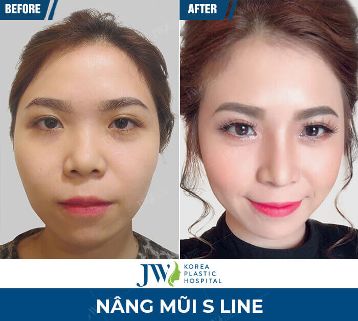 nang mui s line 4