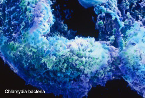 Bệnh Chlamydia là một trong những bệnh nhiễm khuẩn do vi khuẩn Chlamydia trachomatis gây ra.