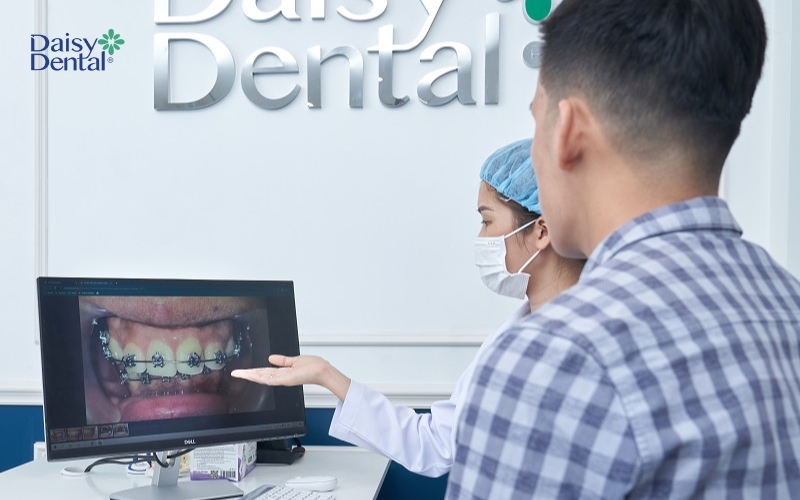 Chỉnh nha cũng là một trong những cách giúp bạn có nụ cười đẹp