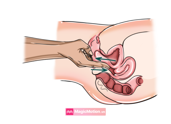 Móc ra vào điểm G