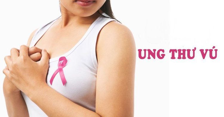 Giai đoạn ung thư vú được các bác sĩ xác định dựa trên sự kết hợp của nhiều yếu tố.