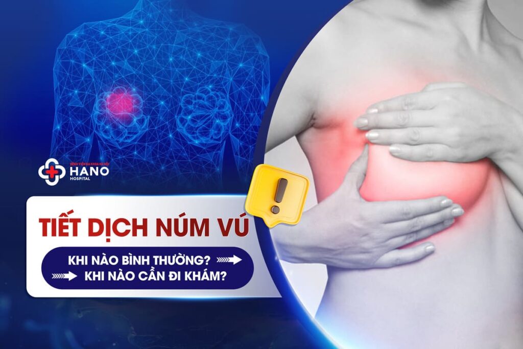Tiết Dịch Núm Vú Khi Nào Bình Thường? Khi Nào Cần Đi Khám?